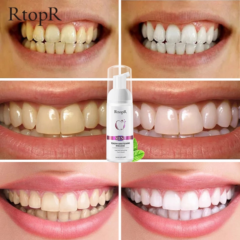 BrightSmile Advanced Teeth Whitening Mousse