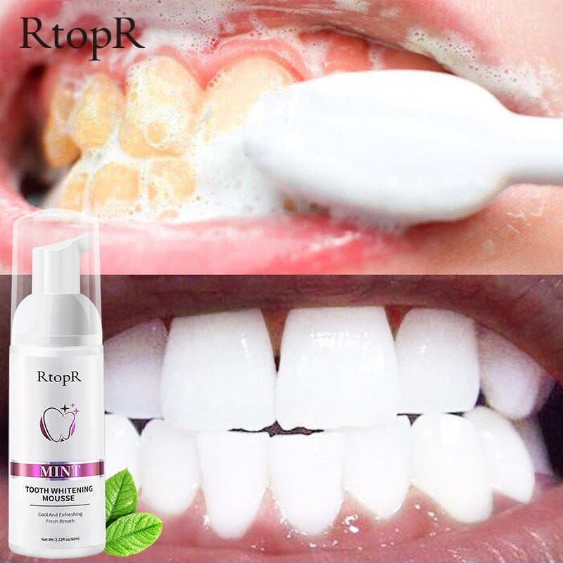 BrightSmile Advanced Teeth Whitening Mousse