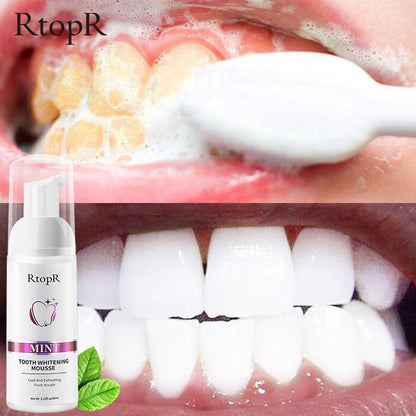 BrightSmile Advanced Teeth Whitening Mousse