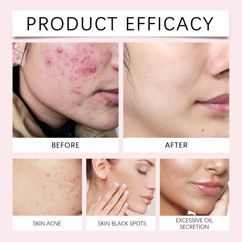 ClearSkin Kojic Turmeric Facial Pads