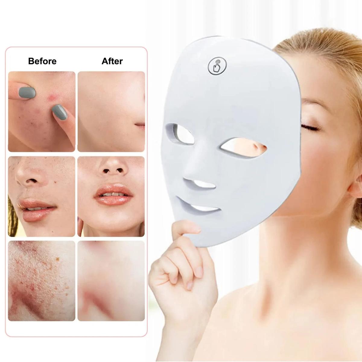 GlowLift 7-Color LED Rejuvenation Mask